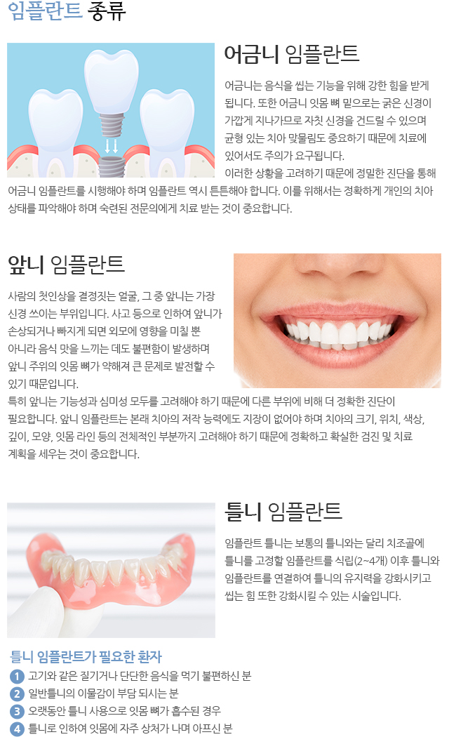 임플란트 종류