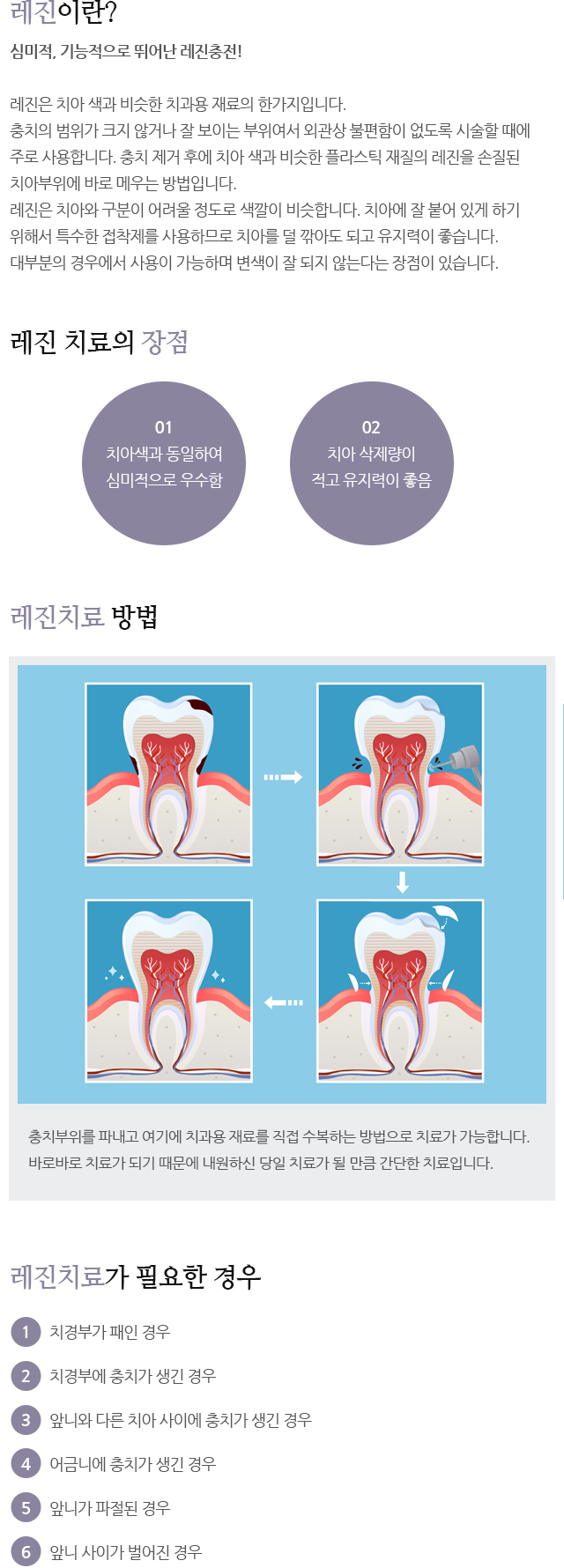 레진