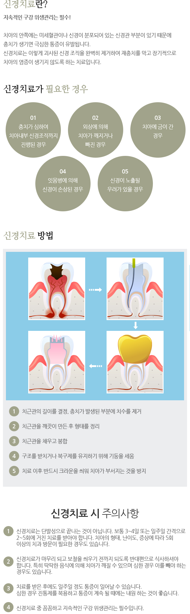 신경치료