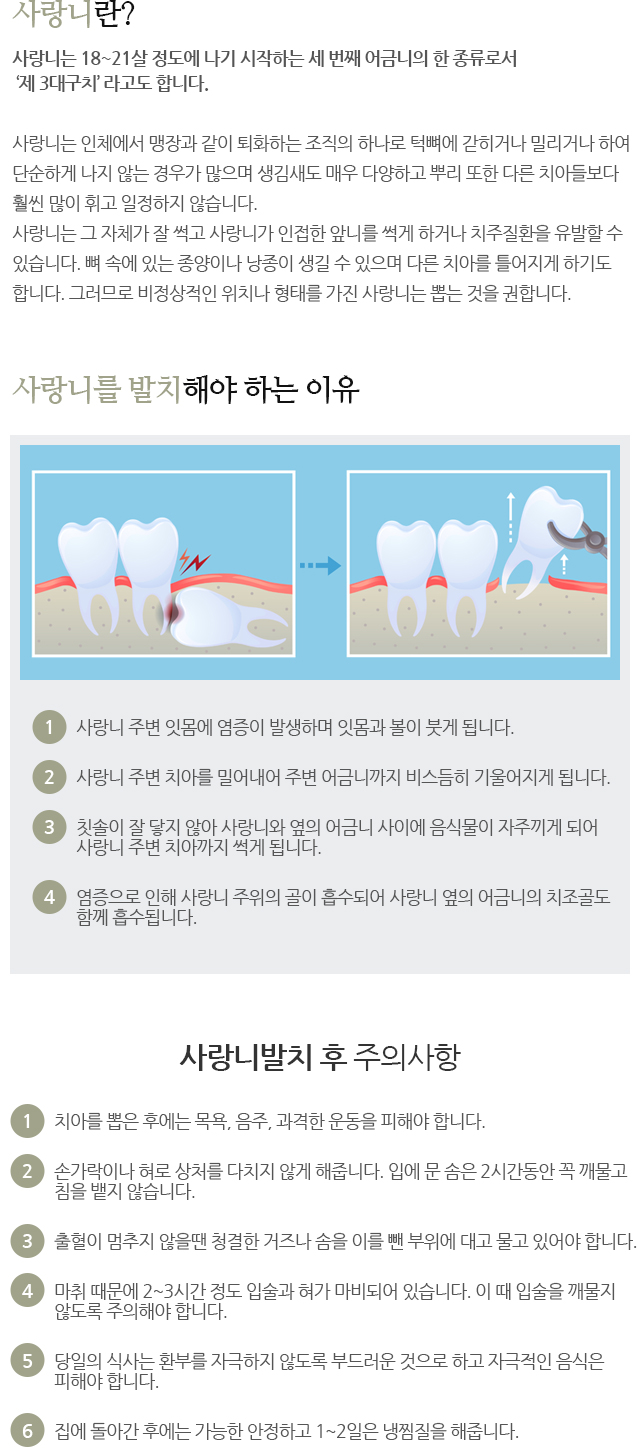 사랑니발치